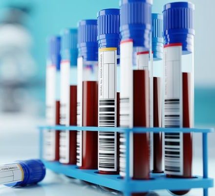 Blood Bank Testing Products