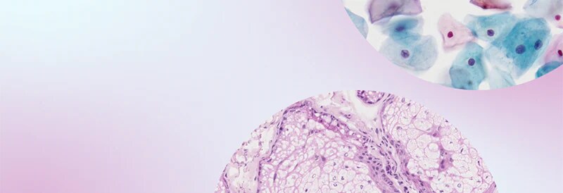 Webinar: Using Telepathology to Advance Patient Care and Lab Workflows