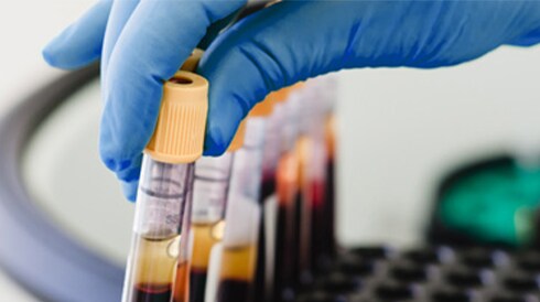 Support your plasma processing workflows with Thermo Scientific filtration solutions. 