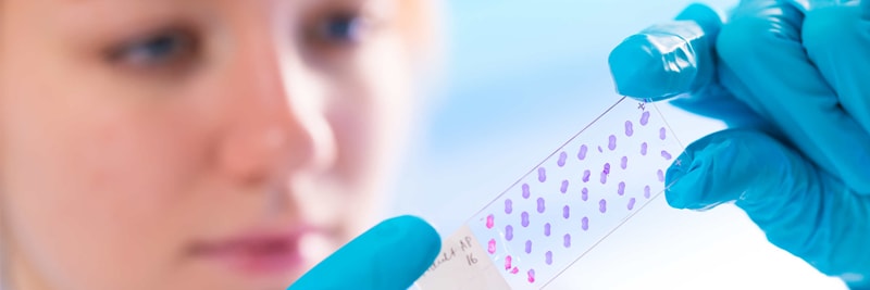 Fisherbrand Histology Slide Comparison Guide