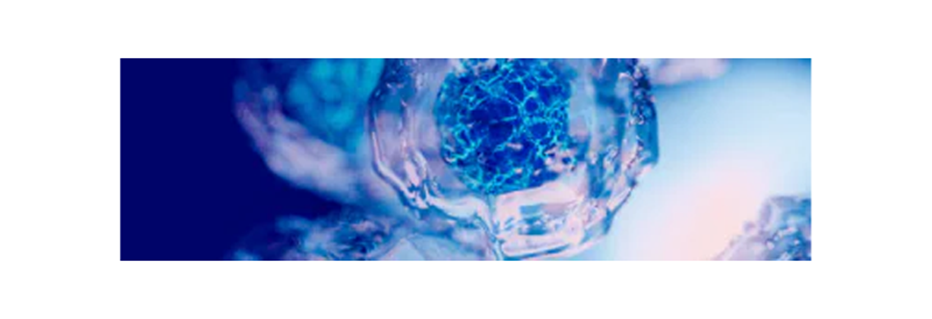 Teaser_Imagery_Layout_dry-analysis