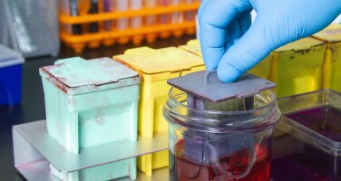 H&E Staining: Science and Troubleshooting H&E Staining: Science and Troubleshooting
